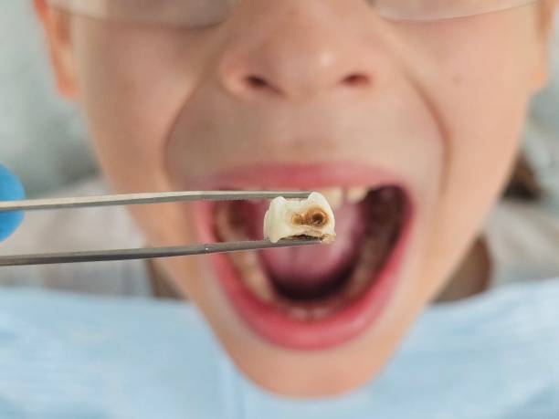 Best Urgent Tooth Repair  in Mchenry, IL